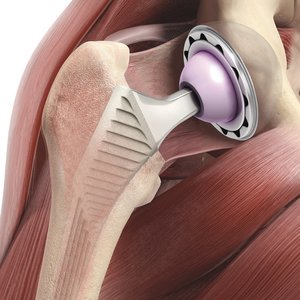 Orthopäde. Orthopädie Unfallchirurgie in Gräfelfing  München